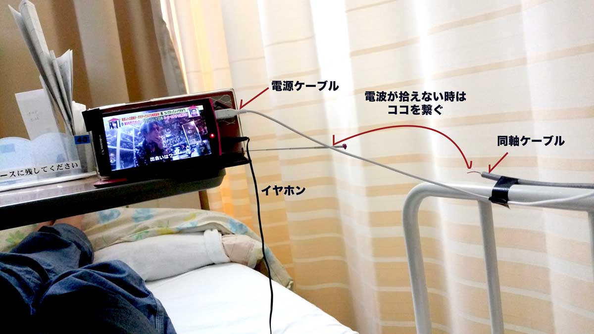 松島病院で無料でテレビを見る方法